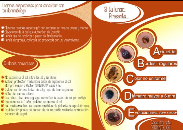 campaña cancer de piel - Vuelve a nuestra ciudad la Campaña de Cáncer de Piel