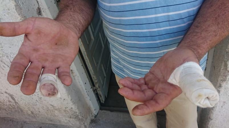 Córdoba: el drama de una niña atacada por la perra pitbull PITBULL VILLA URQUIZA - Córdoba: el drama de una niña atacada por la perra pitbull